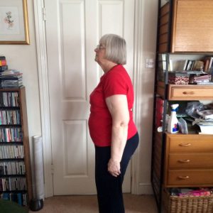 Valerie had a significant posture change Valerie had a significant posture change